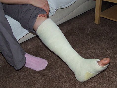 Misure a casa con frattura delle gambe
