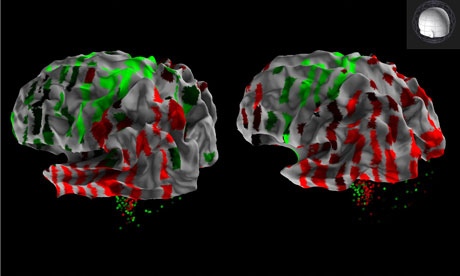 Creato il primo atlante del mondo del cervello umano