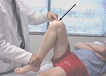 Il dolore al ginocchio durante la flessione è il motivo più comune per cui le persone visitano i medici traumatologici. 