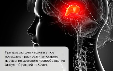 La probabilità di un ictus aumenta nei primi mesi dopo una lesione alla testa o al collo